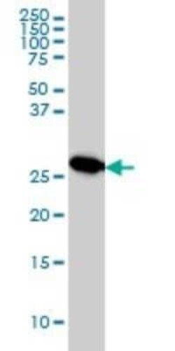 MTAP Antibody (2G4), Novus Biologicals 0.1 mg | Buy Online | Novus Biologicals | Fisher Scientific