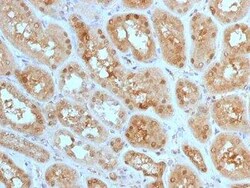 MTAP Antibody (MTAP/1813), Novus Biologicals:Antibodies:Primary Antibodies