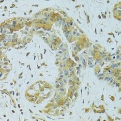 MTCH1 Antibody - BSA Free, Novus Biologicals 0.1 mL; Unconjugated:Anticorps,