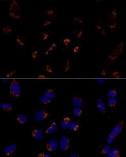 MTCH2 Antibody - Azide and BSA Free, Novus Biologicals 0.02 mL | Buy Online | Novus Biologicals | Fisher Scientific