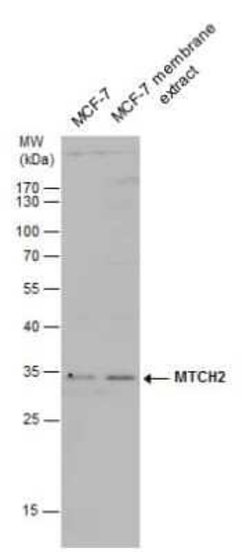 MTCH2 Antibody, Novus Biologicals 100 &mu;g; Unconjugated:Antibodies, Polyclonal
