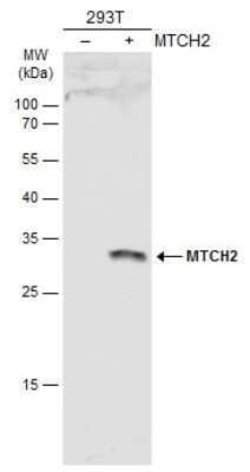 MTCH2 Antibody, Novus Biologicals 100 &mu;g; Unconjugated:Antibodies, Polyclonal