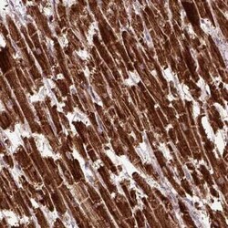 MTCO1 Antibody, Novus Biologicals 25 &mu;L, Unconjugated:Antibodies, Polyclonal