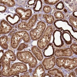 MTCO1 Antibody, Novus Biologicals 25 &mu;L, Unconjugated:Antibodies, Polyclonal