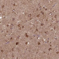 MTCO1 Antibody, Novus Biologicals 25 &mu;L, Unconjugated:Antibodies, Polyclonal
