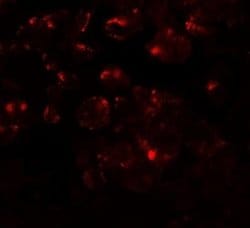 MTERFD1 Antibody - BSA Free, Novus Biologicals 0.1 mg; Unconjugated:Antibodies,