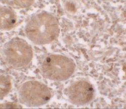 MTERFD2 Antibody - BSA Free, Novus Biologicals 0.1 mg | Buy Online | Novus Biologicals | Fisher Scientific