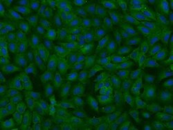 MTHFD1 Antibody, Novus Biologicals 50 &mu;g, Unconjugated:Antibodies, Polyclonal