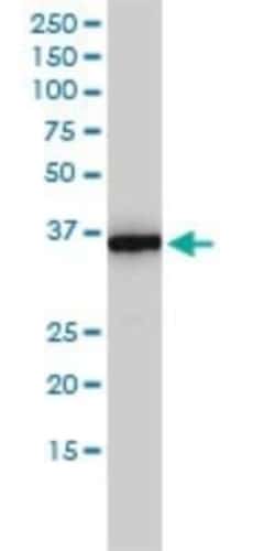 MTHFD2 Antibody (4G7-2G3), Novus Biologicals 0.1 mg, Unconjugated:Antibodies,