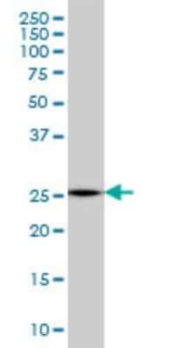 Novus Biologicals MTHFS Antibody (2C12), Novus Biologicals 0.1 mg | Buy Online | Novus Biologicals&trade; | Fisher Scientific