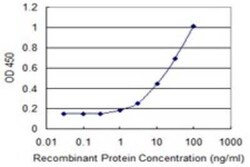 MTMR1 Antibody (1F10), Novus Biologicals 0.1 mg; Unconjugated:Antibodies,