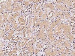 MTMR12 Antibody, Novus Biologicals 50 &mu;g, Unconjugated:Antibodies, Polyclonal
