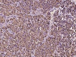 MTMR12 Antibody, Novus Biologicals 50 &mu;g, Unconjugated:Antibodies, Polyclonal