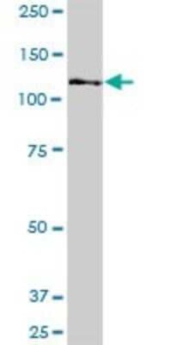 Novus Biologicals MTMR15 Antibody, Novus Biologicals 0.05 mg | Buy Online | Novus Biologicals&trade; | Fisher Scientific