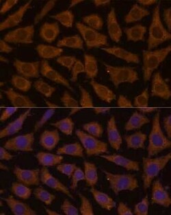 MTMR4 Antibody - Azide and BSA Free, Novus Biologicals:Antibodies:Primary