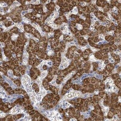 ASB12 Antibody, Novus Biologicals:Antibodies:Primary Antibodies
