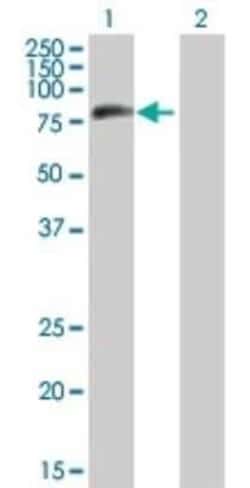 MTMR8 Antibody, Novus Biologicals 0.05 mg, Unconjugated:Antibodies, Polyclonal