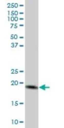 MTP18 Antibody, Novus Biologicals 0.05 mg | Buy Online | Novus Biologicals | Fisher Scientific