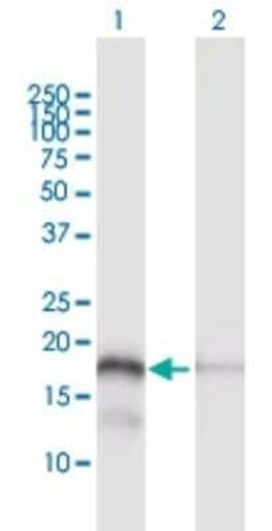 MTP18 Antibody, Novus Biologicals 0.1 mg | Buy Online | Novus Biologicals | Fisher Scientific