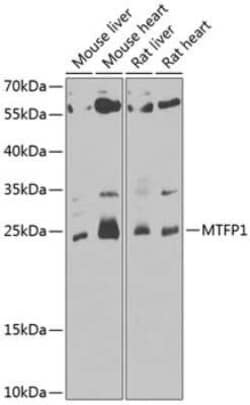 MTP18 Antibody - BSA Free, Novus Biologicals:Antibodies:Primary Antibodies