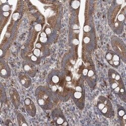 MTRF1L Antibody, Novus Biologicals:Antibodies:Primary Antibodies
