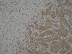 MTSS1 Antibody (M7P3A7) - BSA Free, Novus Biologicals 0.025 mL, Unconjugated:Antibodies,