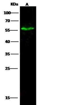 MTSS1 Antibody, Novus Biologicals 50 &mu;g; Unconjugated:Antibodies, Polyclonal