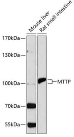 MTTP Antibody - Azide and BSA Free, Novus Biologicals:Antibodies:Primary