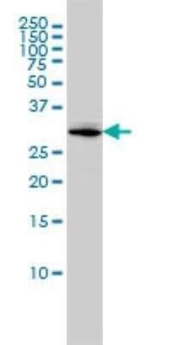 MTUS1 Antibody (1C7), Novus Biologicals 0.1 mg | Buy Online | Novus Biologicals | Fisher Scientific