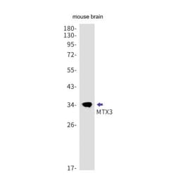 MTX3 Antibody (S08-2K4), Novus Biologicals 100 &mu;g; Unconjugated:Antibodies,