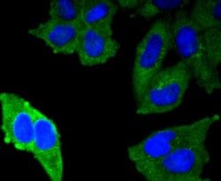 MUC1 Antibody (SN06-80), Novus Biologicals 100&mu;L:Antibodies, Monoclonal