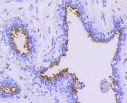 MUC1 Antibody (SN06-80), Novus Biologicals 100&mu;L:Antibodies, Monoclonal