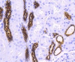 MUC1 Antibody (SN06-80), Novus Biologicals 100&mu;L:Antibodies, Monoclonal