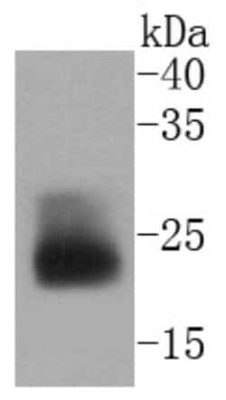 MUC1 Antibody (SN06-80), Novus Biologicals 100&mu;L:Antibodies, Monoclonal