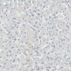 MUC1 Antibody, Novus Biologicals 25 &mu;L | Buy Online | Novus Biologicals | Fisher Scientific