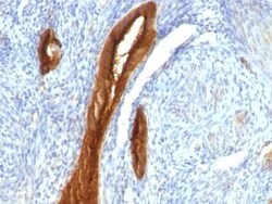 MUC1 Antibody (139H2), Novus Biologicals 0.02mg; Unlabeled:Antibodies,