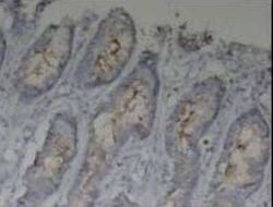 MUC1 Antibody - BSA Free, Novus Biologicals 0.025 mg; Unconjugated:Antibodies,