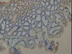 MUC1 Antibody - BSA Free, Novus Biologicals 0.025 mg; Unconjugated:Antibodies,