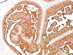 MUC1 Antibody (MUC1/520), Novus Biologicals:Antibodies:Primary Antibodies