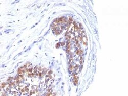 MUC1 Antibody (MUC1/520), Novus Biologicals:Antibodies:Primary Antibodies
