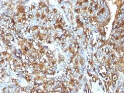 MUC1 Antibody (MUC1/520), Novus Biologicals:Antibodies:Primary Antibodies