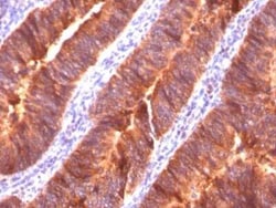 MUC1 Antibody (MUC1/520), Novus Biologicals:Antibodies:Primary Antibodies