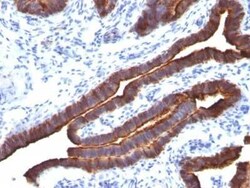 MUC1 Antibody (MUC1/520), Novus Biologicals:Antibodies:Primary Antibodies