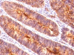 MUC1 Antibody (MUC1/845), Novus Biologicals:Antibodies:Primary Antibodies