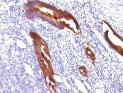 MUC1 Antibody (MUC1/845), Novus Biologicals:Antibodies:Primary Antibodies