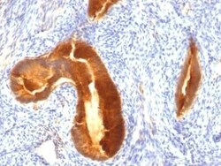 MUC1 Antibody (MUC1/955), Novus Biologicals 0.02mg; Unlabeled:Antibodies,