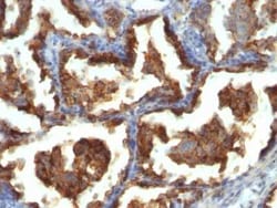 MUC1 Antibody (MUC1/955), Novus Biologicals 0.02mg; Unlabeled:Antibodies,