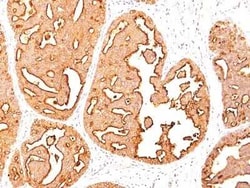MUC1 Antibody (MUC1/967), Novus Biologicals 0.1mg; Unlabeled:Antibodies,