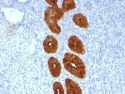 MUC1 Antibody (MUC1/967), Novus Biologicals 0.1mg; Unlabeled:Antibodies,