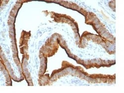 MUC1 Antibody (MUC1/967), Novus Biologicals 0.1mg; Unlabeled:Antibodies,